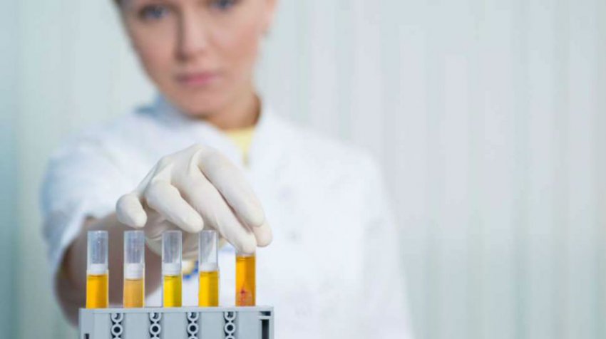 Общий анализ мочи: расшифровка результатов, таблица нормы у взрослых